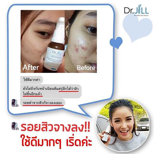 ครีมแพท ณปภา ราคา, dr.jill รีวิว ราคา, dr.jill มีขายที่ไหนบ้าง, dr jill ราคา เท่า ไหร่, dr jill รีวิว, dr jill ดีไหม,Dr.Jill,ดอกเตอร์จิล,แพท ณปภา,dr.jill ของแท้ ,dr.jill มีขายที่ไหนบ้าง, dr.jill ราคา, dr.jill ราคาเท่าไหร่ ,dr.jill วิธีใช้ ,dr.jill สรรพคุณ